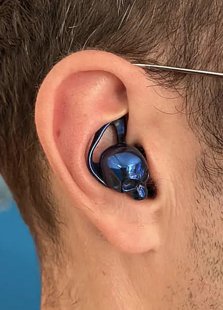 Detailaufnahem eine Ohres mit einer Otoplastik